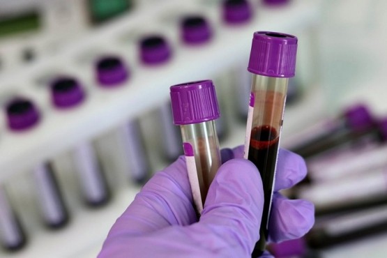 Punkt pobrań krwi i badań laboratoryjnych